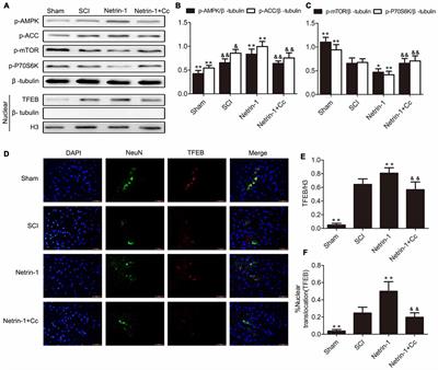 The Role of Netrin-1 in Improving Functional Recovery through Autophagy Stimulation Following Spinal Cord Injury in Rats